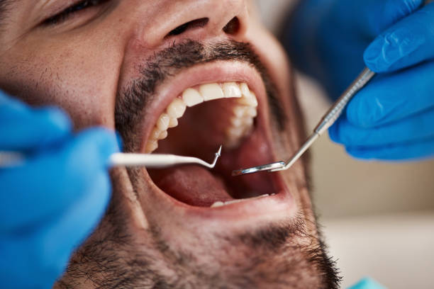 Best Urgent Care for Lost Fillings or Crowns in Delano, MN